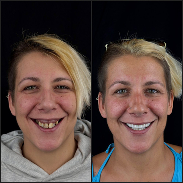 Slider image (6) A2 Dental: Premier Dental Clinic in Croatia